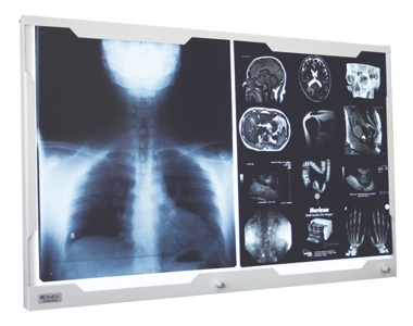 Equipamentos Radiologia - Negatoscpios LED - Negatoscpio 2 Corpos Led Konex de Parede